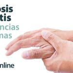 Artritis y artrosis: conoce las diferencias