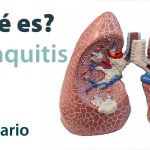 Síntomas y tratamiento de la bronquitis
